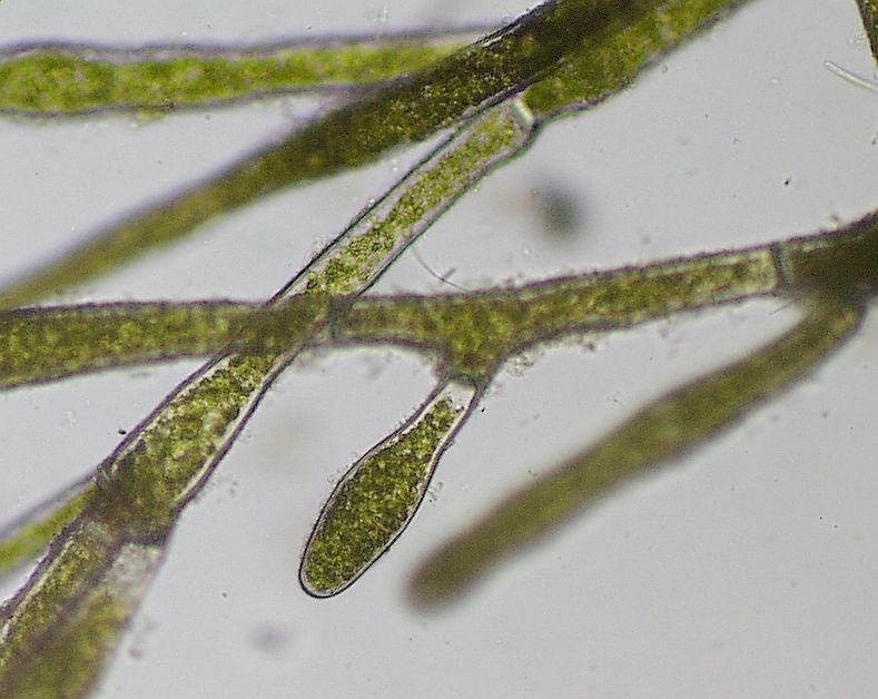 Нить зеленой водоросли под микроскопом